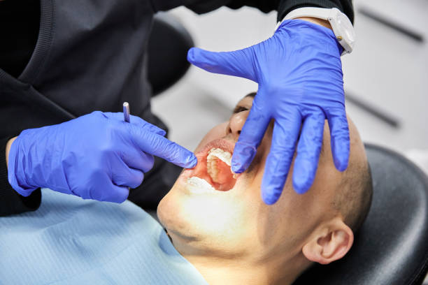 Best Emergency Tooth Extraction in Frankton, IN